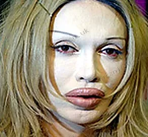 Pete Burns picture quiz clue